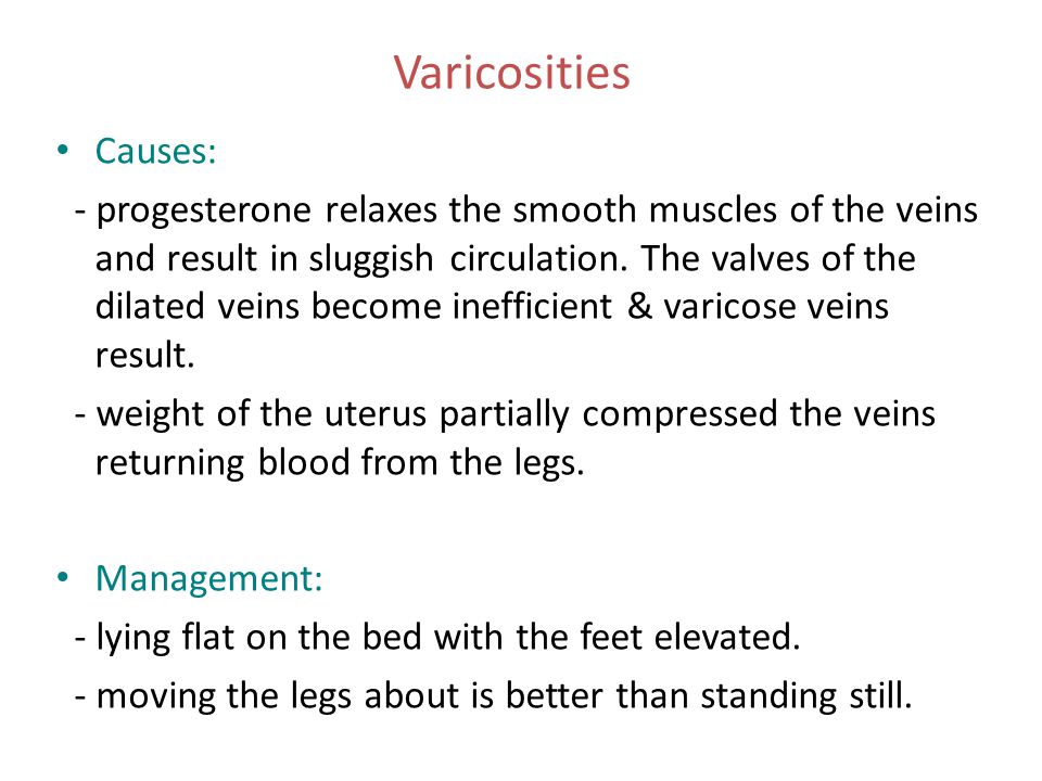Varicosities Causes: