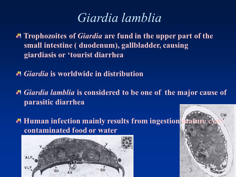 giardia gallbladder