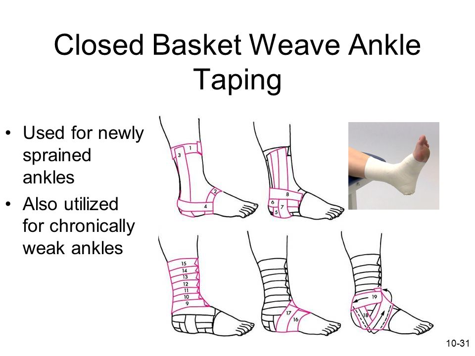 Chapter 10: Wrapping and Taping Techniques - ppt video online download