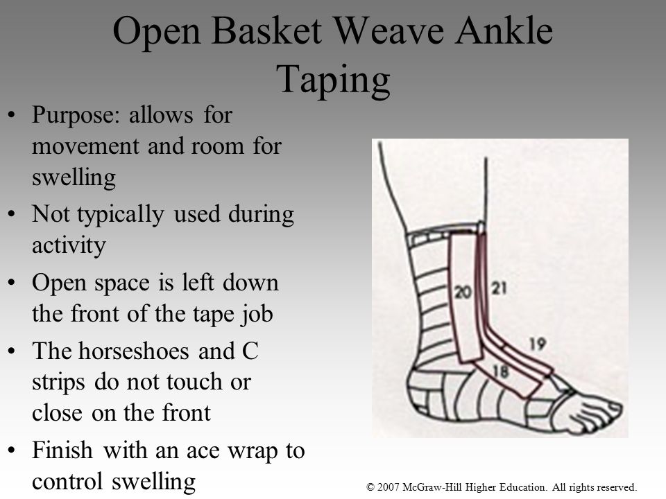 basket weave ankle strapping