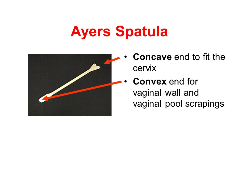 Ayers+Spatula+Concave+end+to+fit+the+cervix.jpg