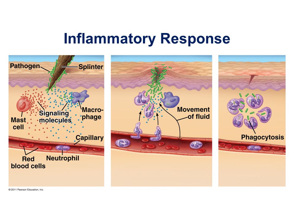 Inflammatory Response.