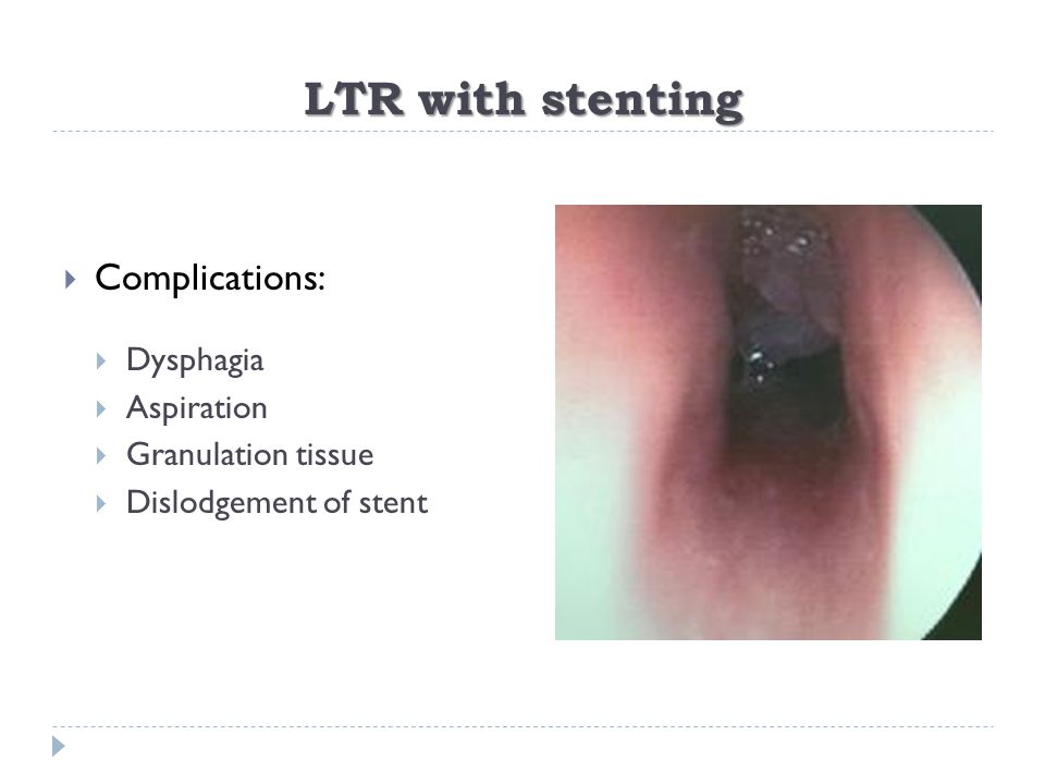 LTR with stenting Complications: Dysphagia Aspiration