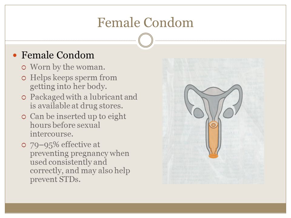 Female Condom Female Condom Worn by the woman.