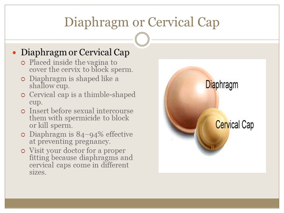 Diaphragm or Cervical Cap