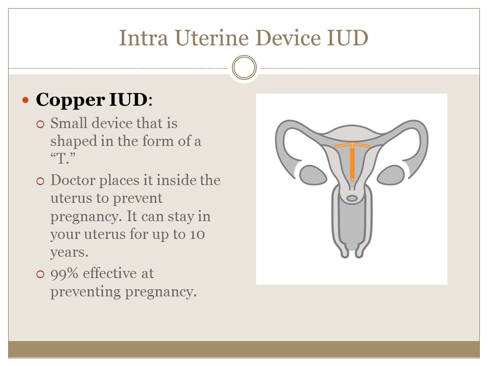 Intra Uterine Device IUD