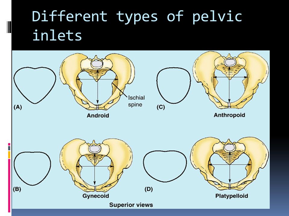Different types of pelvic inlets