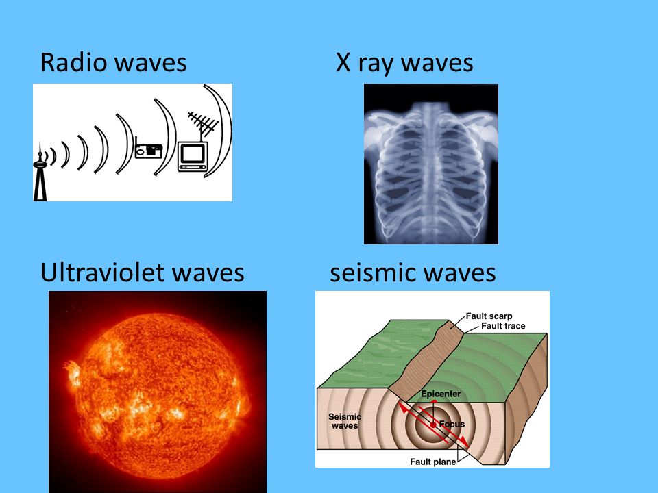 Radio waves X ray waves Ultraviolet waves seismic waves