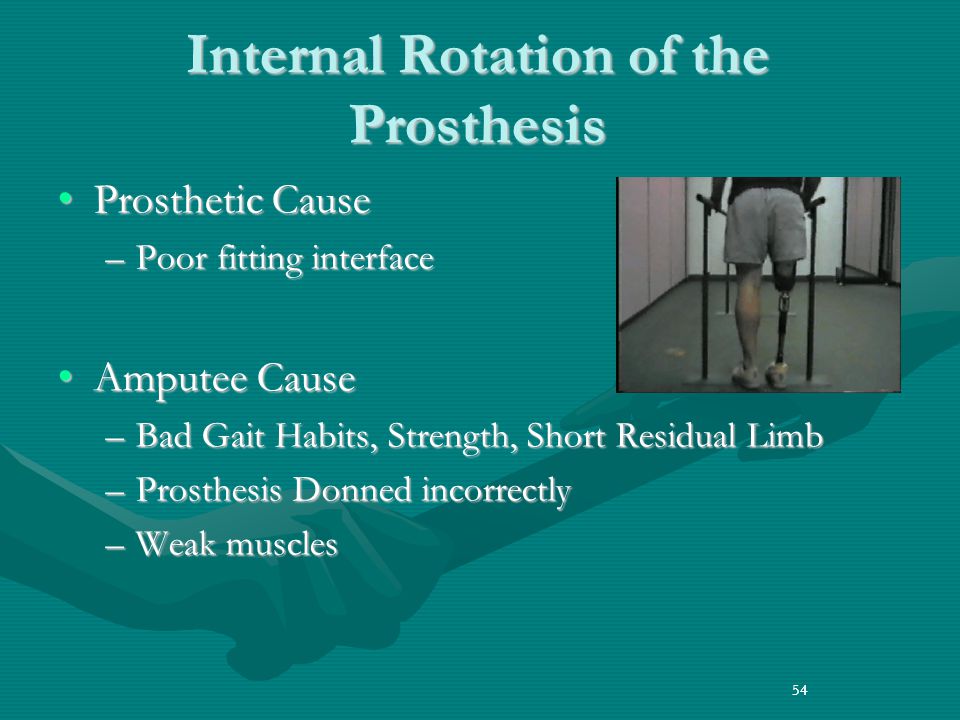LE Prosthetic Gait Assessment & Deviation - ppt download