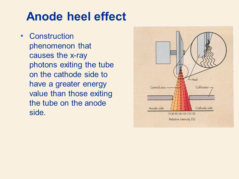 PDF) 'Anode heel effect' on patient dose in lumbar spine radiography