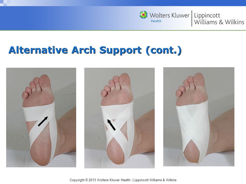 Protective Taping and Wrapping - ppt 