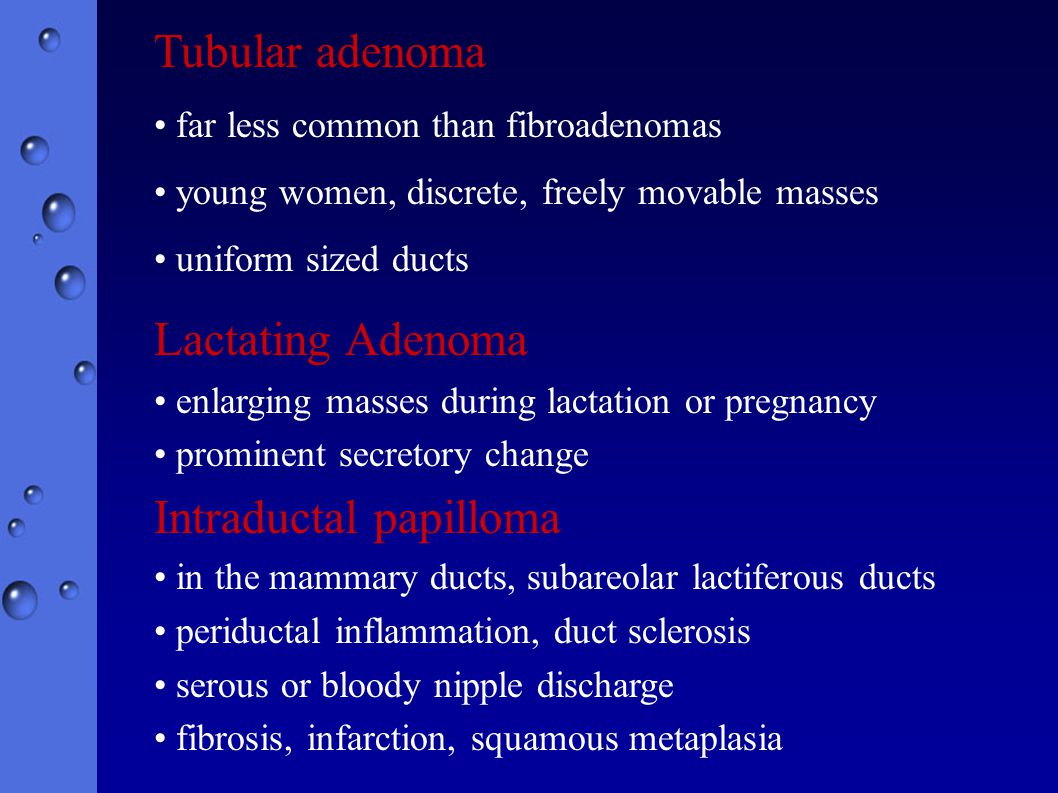 duct papilloma ppt)