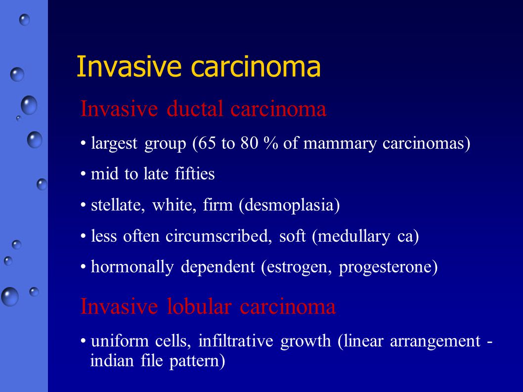 invasive ductal carcinoma pathophysiology