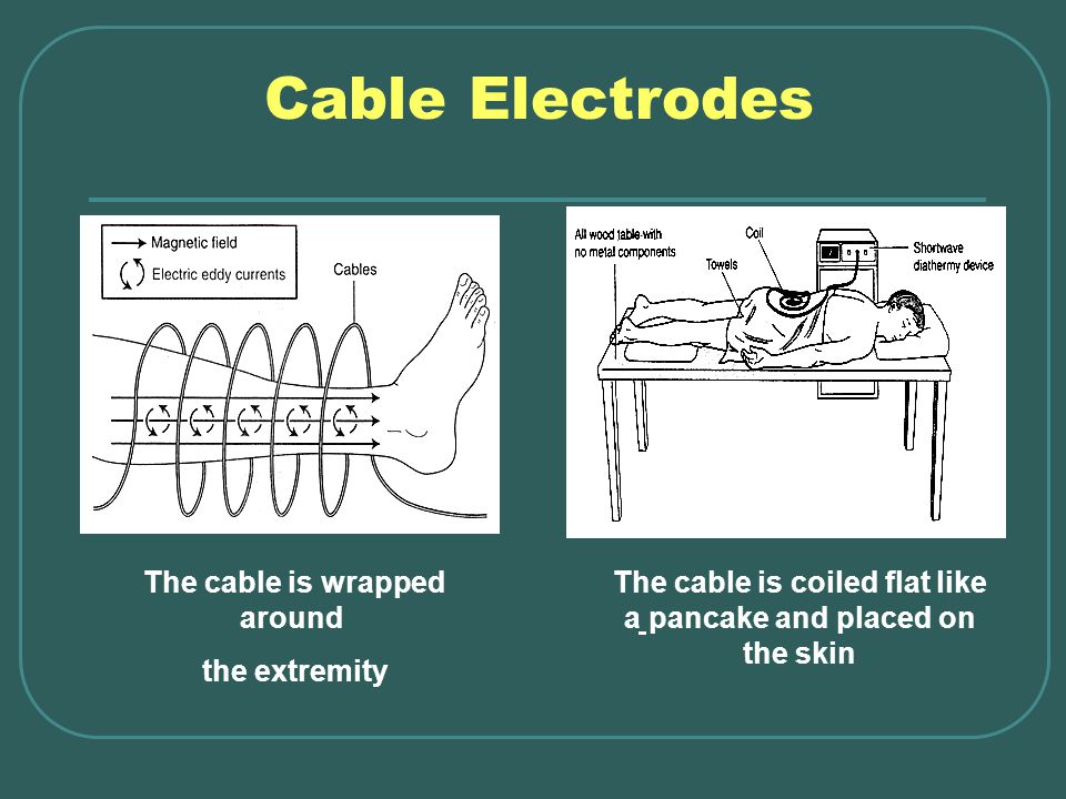 Shortwave Diathermy Prof. Dr. Gehan Mosaad. - ppt video online ...