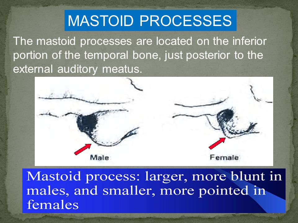 MASTOID PROCESSES The mastoid processes are located on the inferior portion of the temporal bone, just posterior to the external auditory meatus.