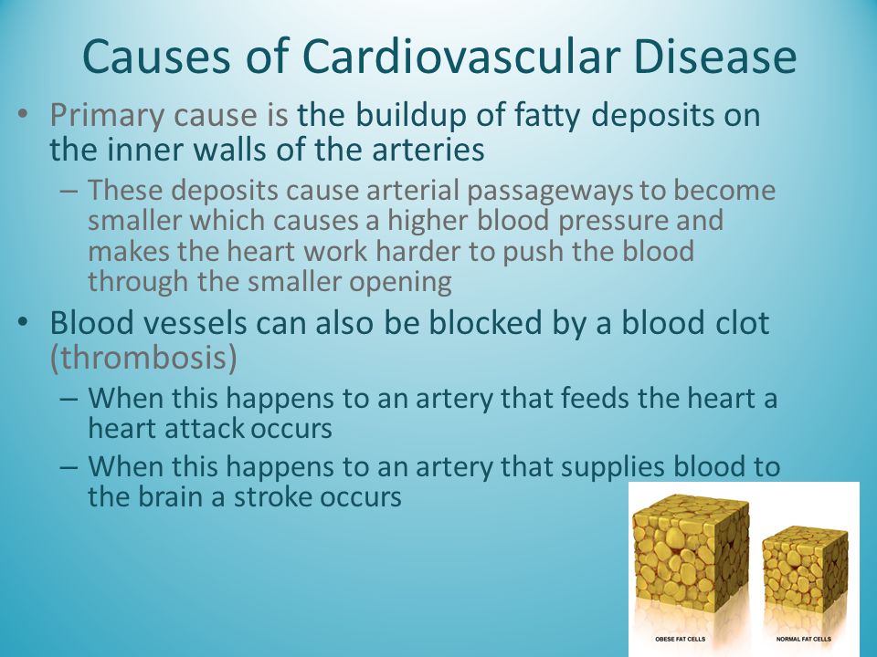 Causes of Cardiovascular Disease