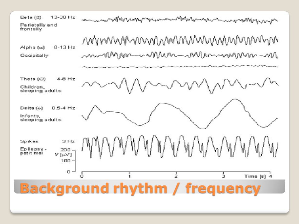 Ээг сигнал. Частотный диапазон Альфа ритма на ЭЭГ. Альфа ритм ЭЭГ. Альфа и бета ритмы на ЭЭГ. Ритмы ЭЭГ физиология.