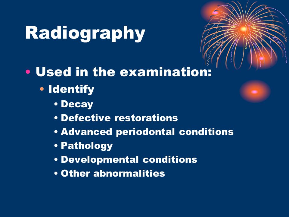 Radiography Used in the examination: Identify Decay