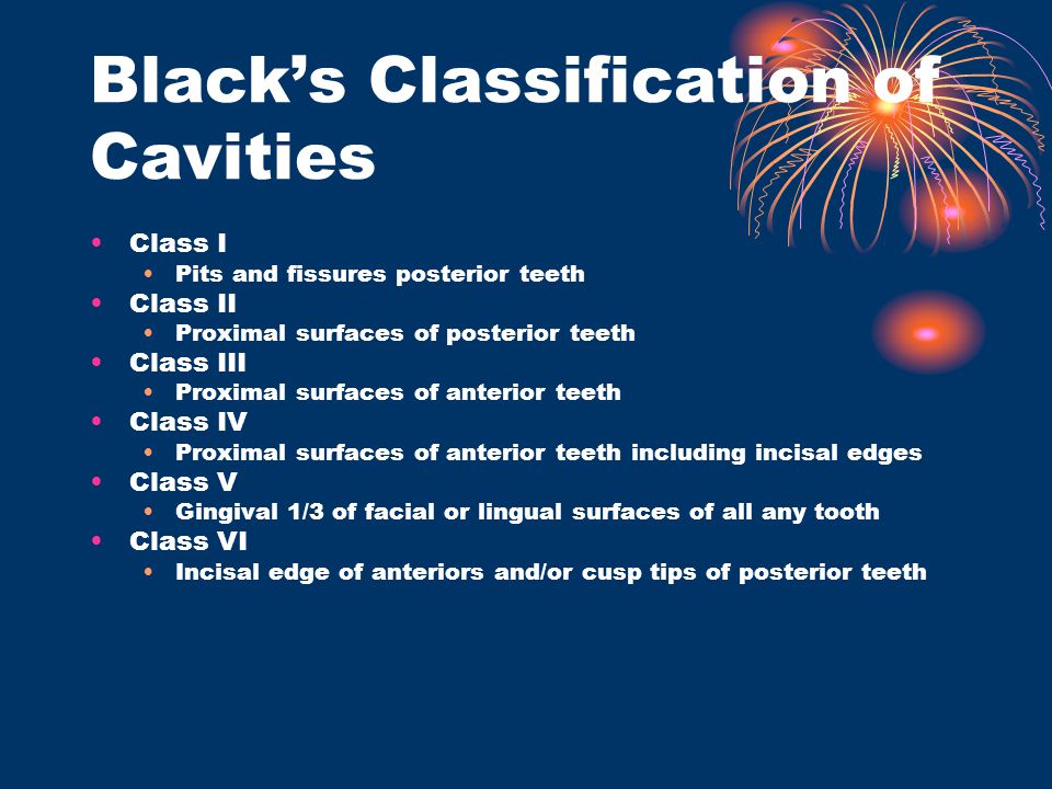 Black’s Classification of Cavities
