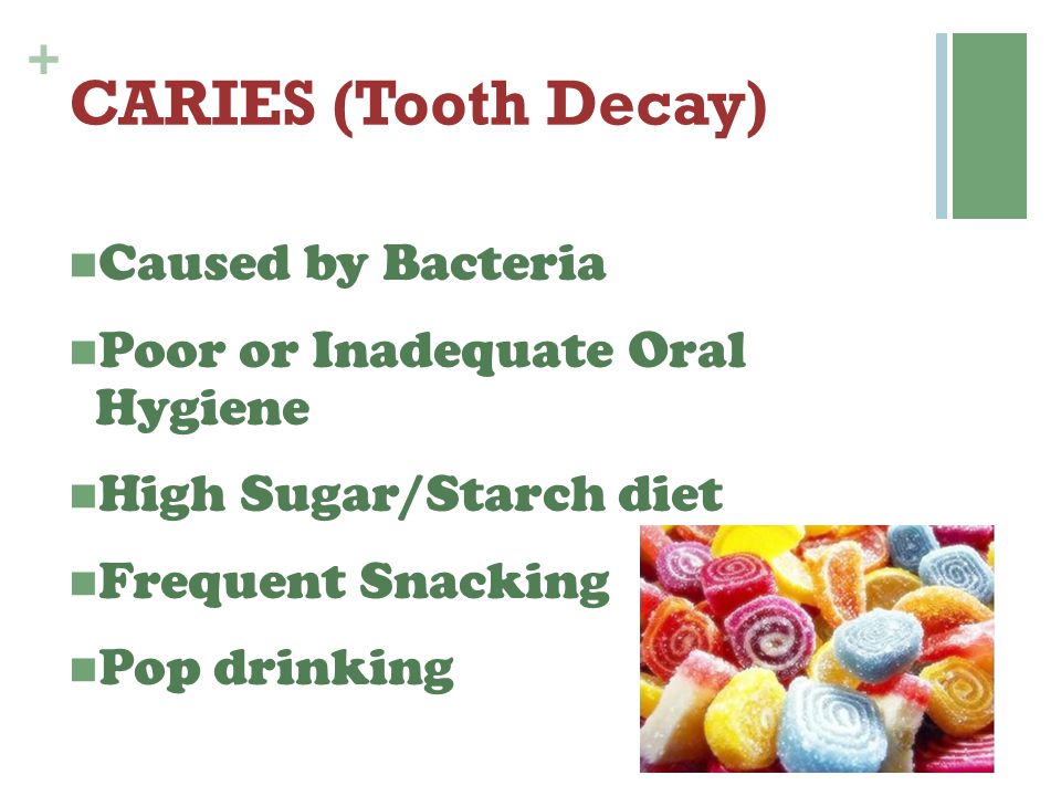 CARIES (Tooth Decay) Caused by Bacteria