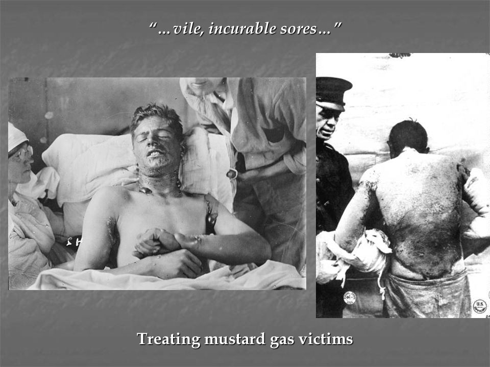 …vile, incurable sores… Treating mustard gas victims