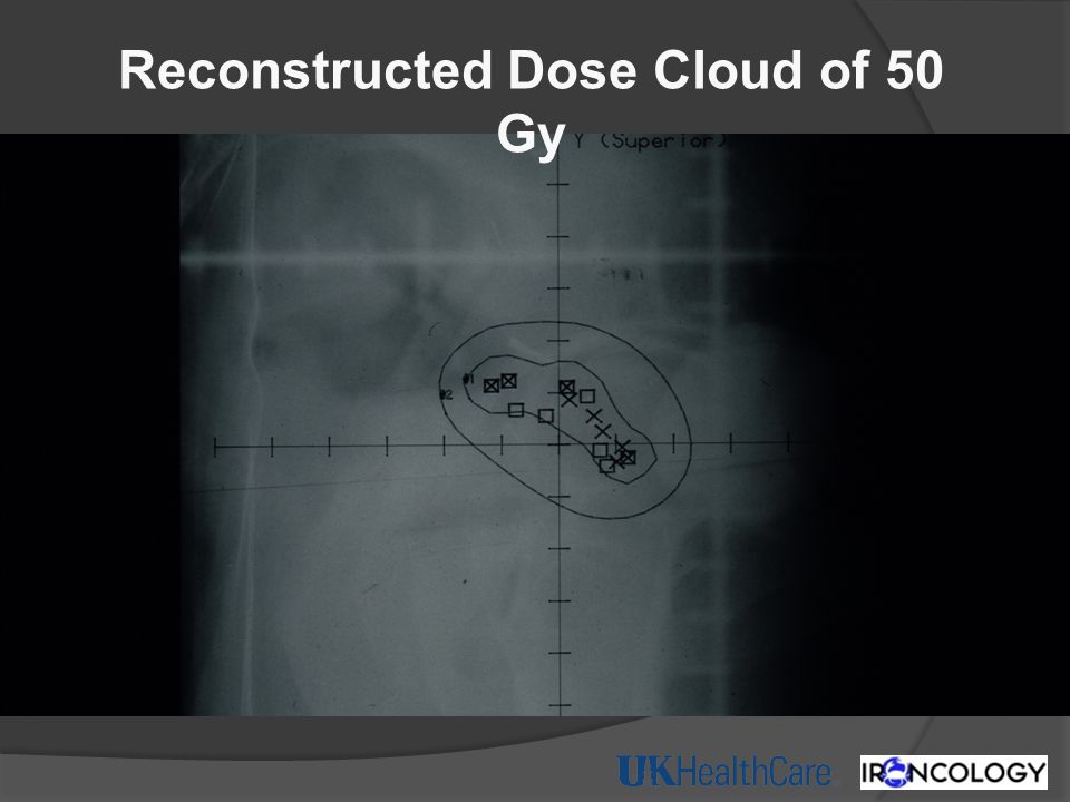 Reconstructed Dose Cloud of 50 Gy