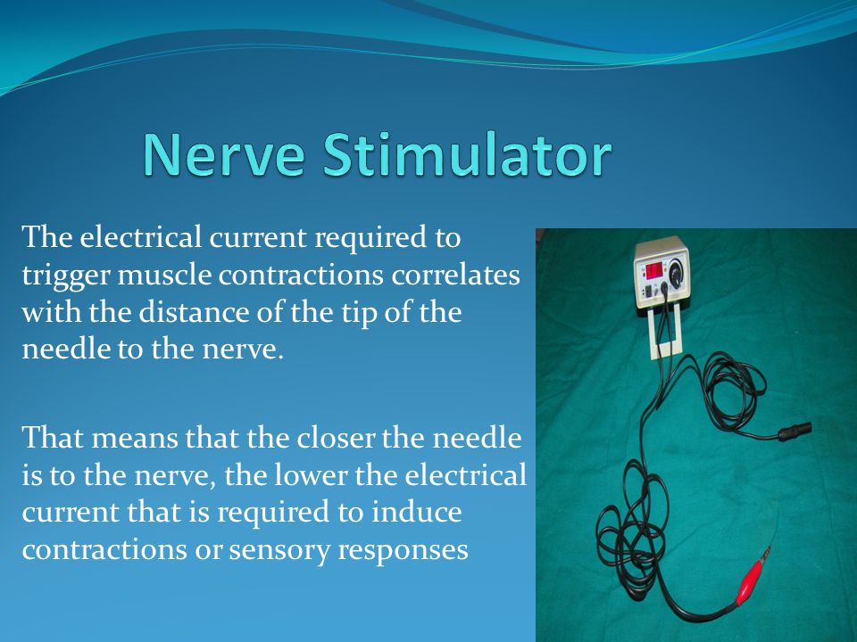 Current is required. Tens muscle Stimulator схема. Стимулятор Hilger. Ремонт nerve and muscle Stimulator. Peripheral nerve field stimulation device.