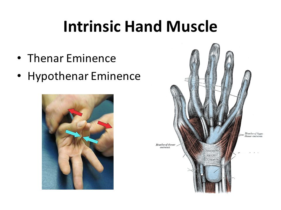 Intrinsic Hand Muscle. 