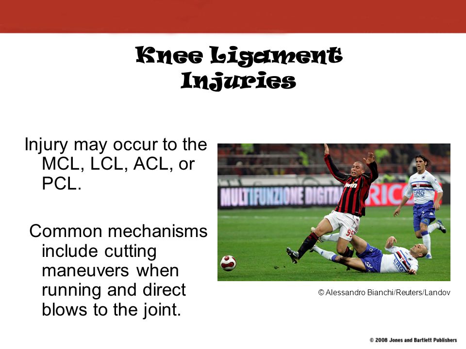 Injuries to the Thigh, Leg, and Knee - ppt video online download