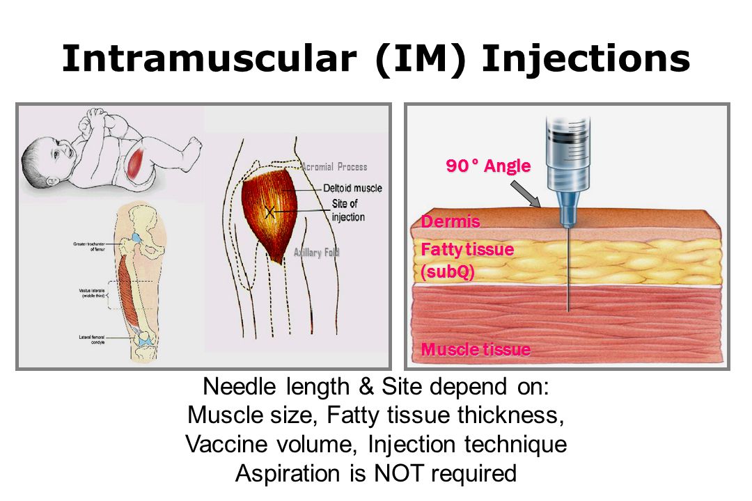 Vaccine Administration - ppt download