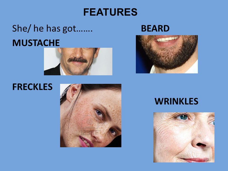 FEATURES She/ he has got……. BEARD MUSTACHE FRECKLES WRINKLES