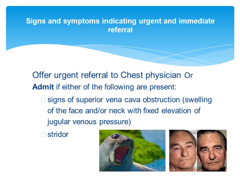 Signs and symptoms indicating urgent and immediate referral