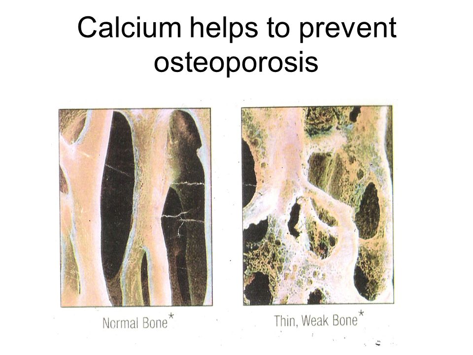 Calcium helps to prevent osteoporosis