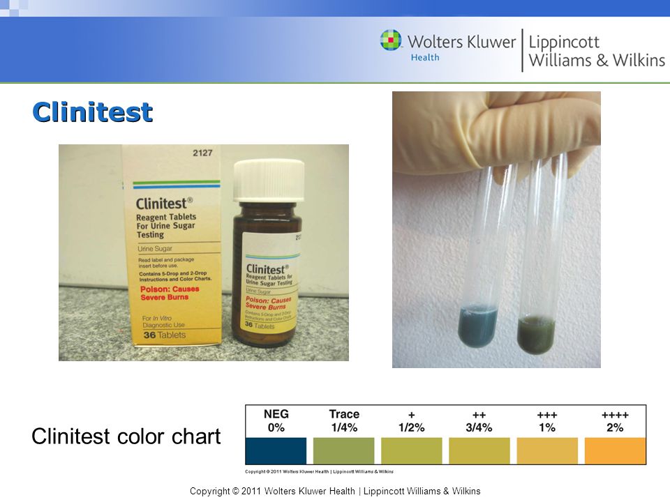 Clinitest Tablets Color Chart