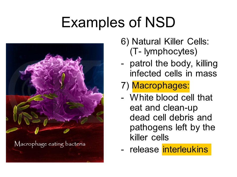 Examples of NSD 6) Natural Killer Cells: (T- lymphocytes)