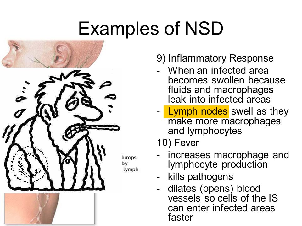Examples of NSD 9) Inflammatory Response