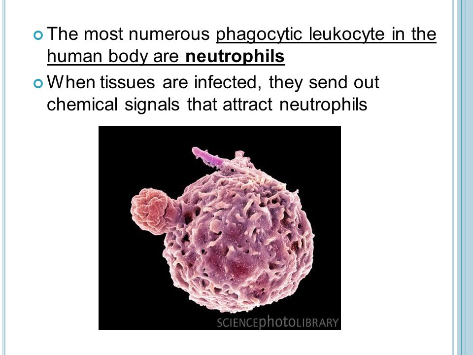 The most numerous phagocytic leukocyte in the human body are neutrophils