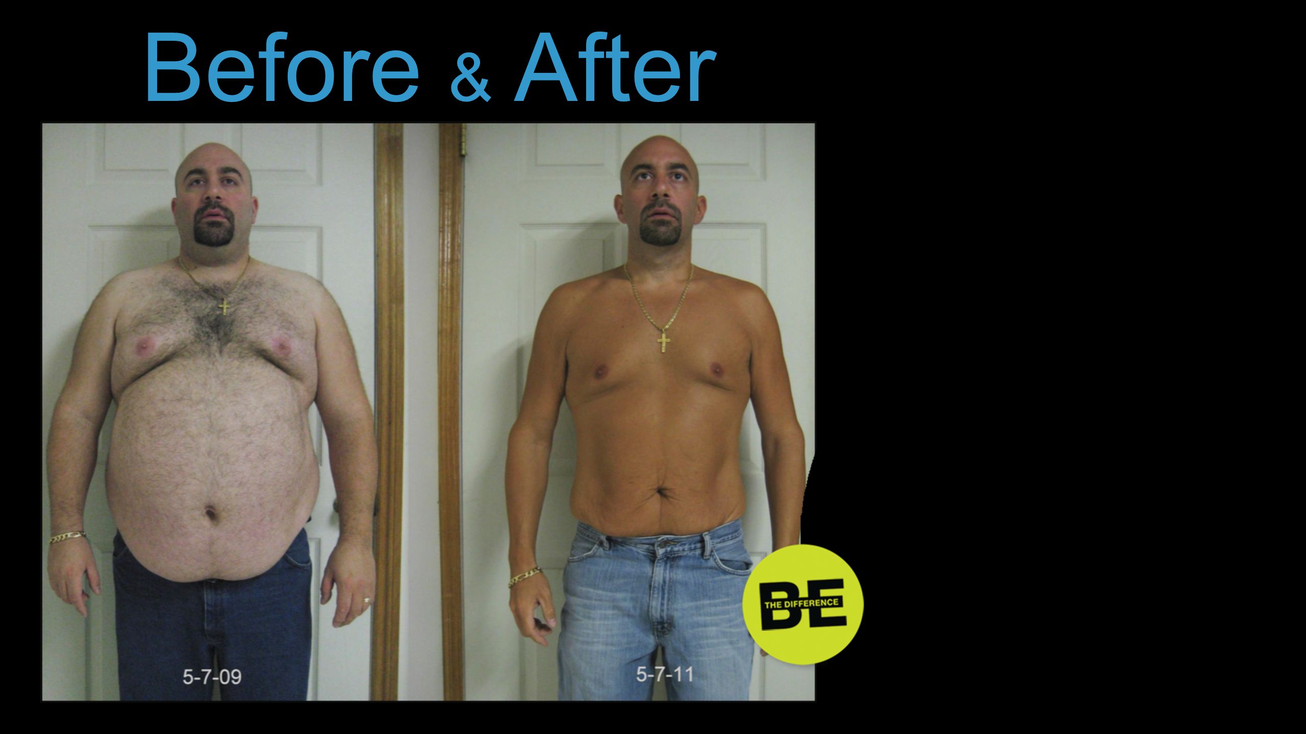 Before & After … or lost weight.