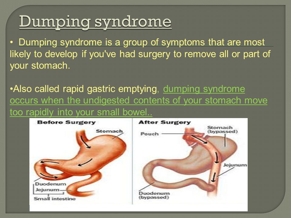 Git Disorders Ppt Download