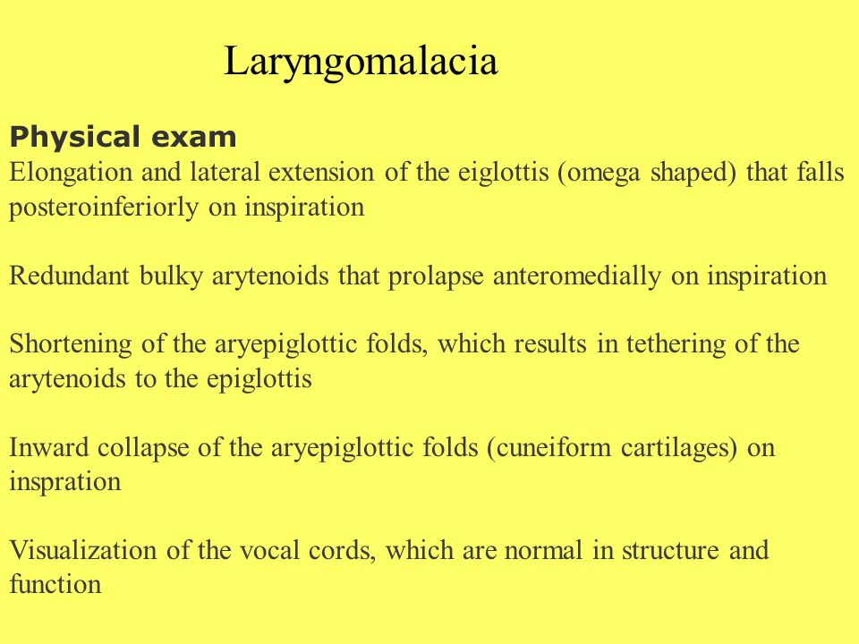 Laryngomalacia Physical exam