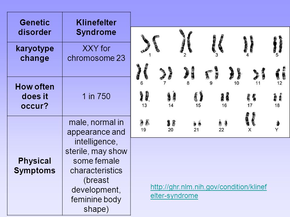 Xxy хромосома. Klinefelter Syndrome karyotype. Синдром Клайнфельтера кариотип. Синдром Клайнфельтера хромосомный набор.