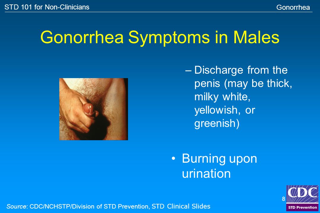 Normal Penile Discharge Or An Std