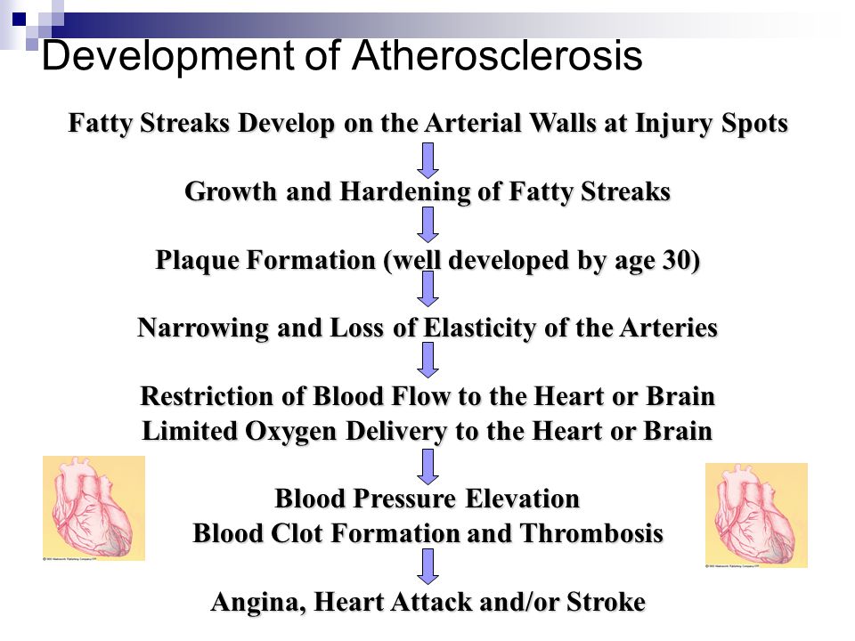 Development of Atherosclerosis