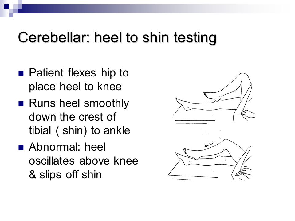 Cerebellar%3A+heel+to+shin+testing