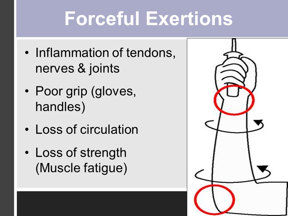 Forceful Exertions Inflammation of tendons, nerves & joints