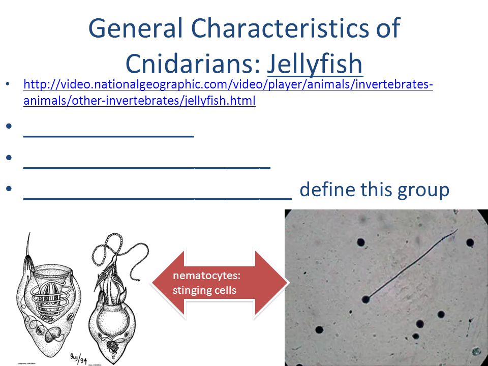 General Characteristics of Cnidarians: Jellyfish