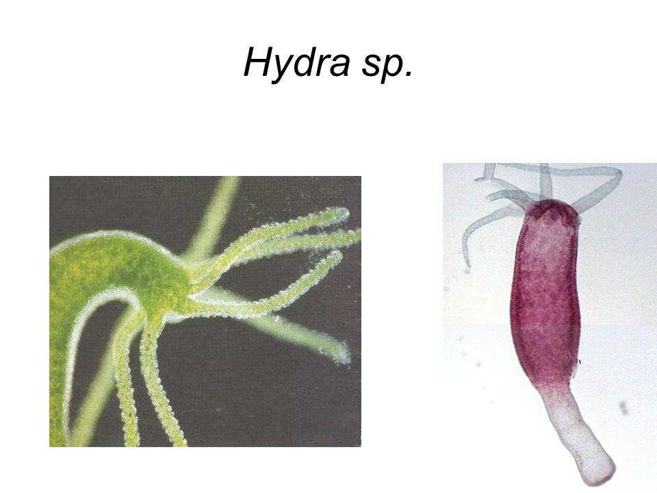 Hydra sp.