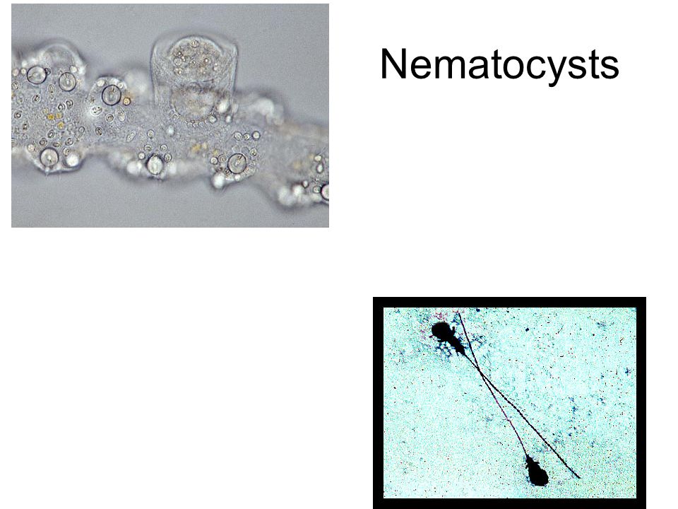 Nematocysts