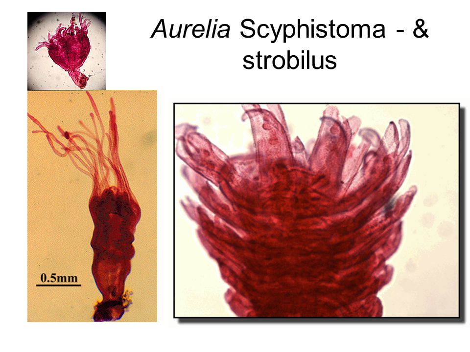 Aurelia Scyphistoma - & strobilus