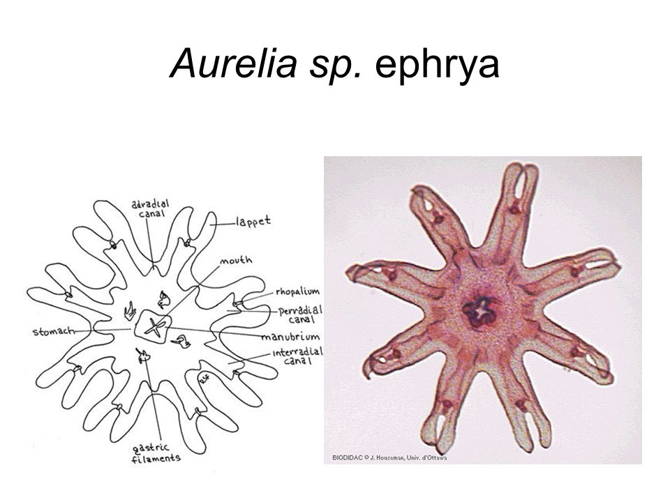 Aurelia sp. ephrya